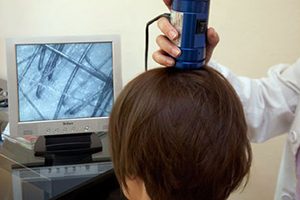 visita-tricologica-4