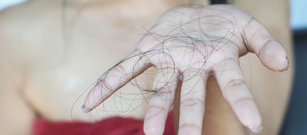 perchè-perdiamo-i-capelli
