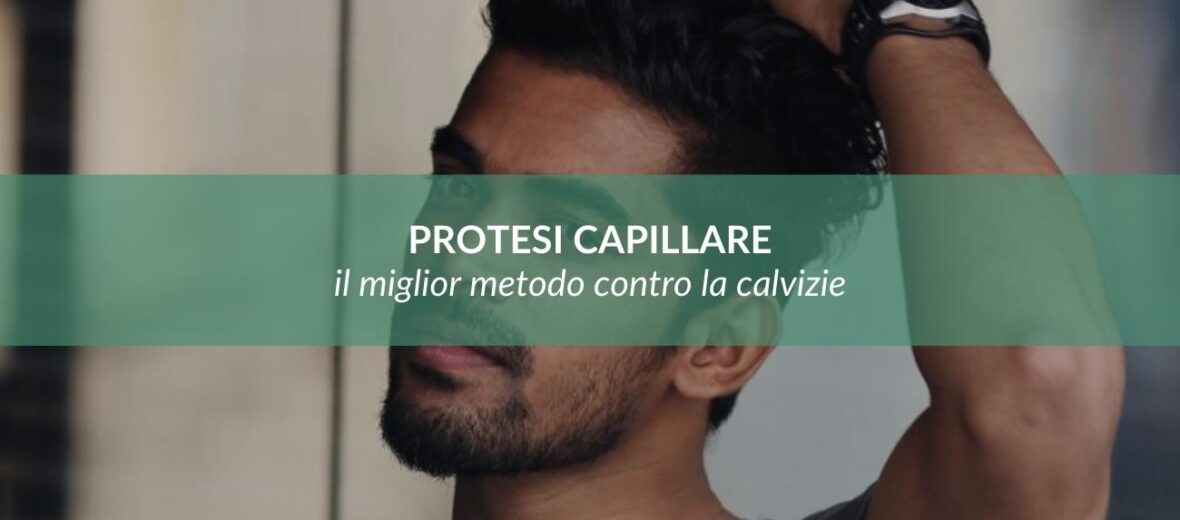 Protesi Capillare