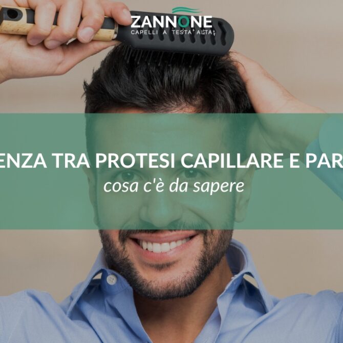 Differenza tra protesi capillare e parrucca